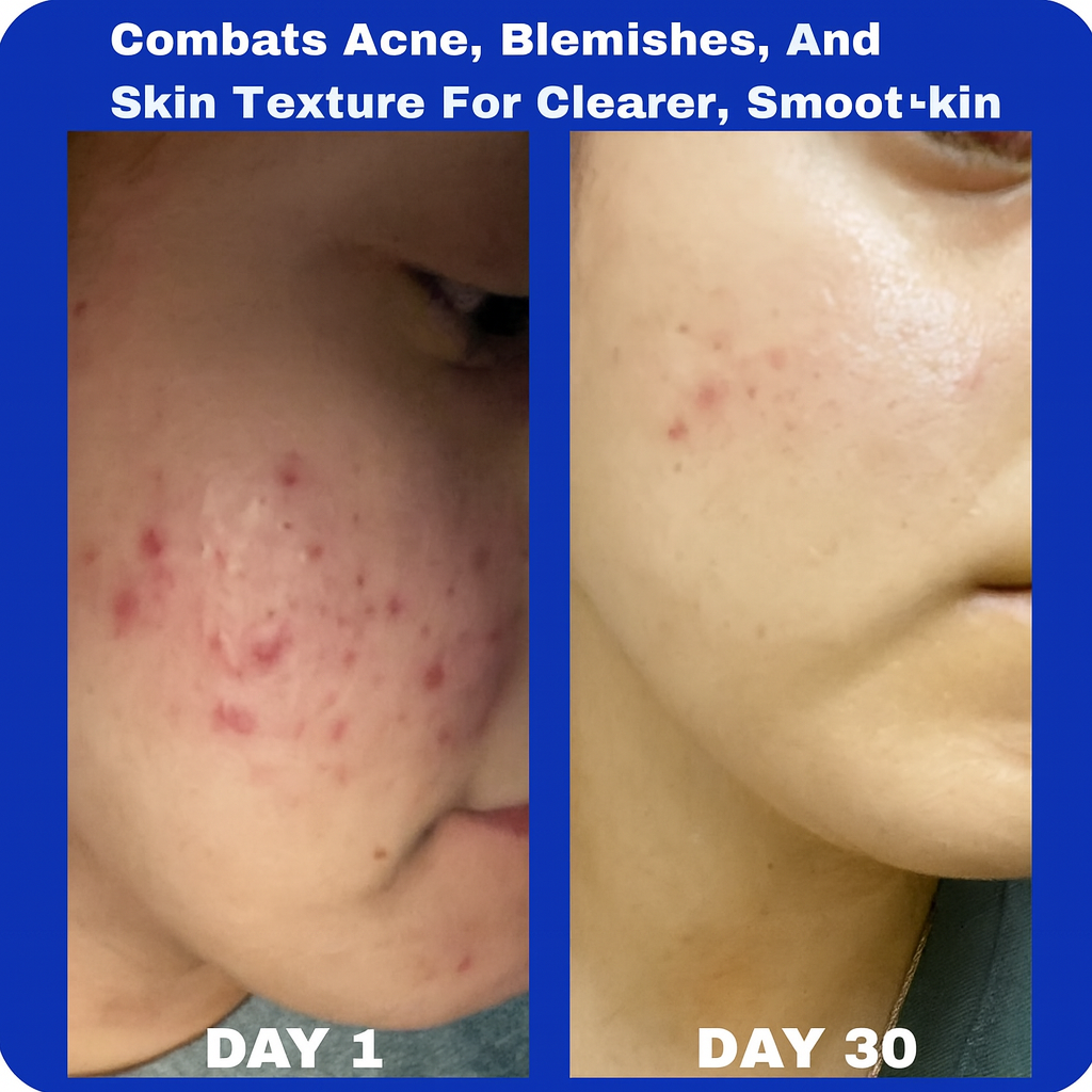 Verela™ Gentle Retinol Cream
