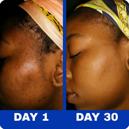 Verela™ Gentle Retinol Cream